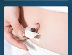 艾草肚臍貼：傳統(tǒng)智慧與現(xiàn)代便捷的完美融合